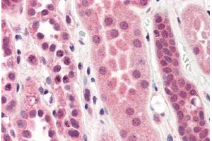 Human Kidney (formalin-fixed, paraffin-embedded) stained with STEAP1 antibody ABIN364397 at 10 ug/ml followed by biotinylated anti-mouse IgG secondary antibody ABIN481714, alkaline phosphatase-streptavidin and chromogen. (STEAP1 Antikörper  (AA 1-70))