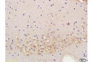 Formalin-fixed and paraffin embedded mouse kidney labeled with Anti RASSF3 Polyclonal Antibody, Unconjugated (ABIN762101) at 1:200 followed by conjugation to the secondary antibody and DAB staining (RASSF3 Antikörper  (AA 51-150))