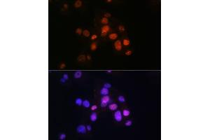 Immunofluorescence analysis of Hep G2 cells using HNF3β/HNF3β/FOX Rabbit mAb (ABIN7267232) at dilution of 1:100 (40x lens). (FOXA2 Antikörper)
