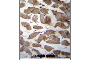 ACTN3 Antibody (Center) (ABIN656261 and ABIN2845575) immunohistochemistry analysis in formalin fixed and paraffin embedded human skeletal muscle followed by peroxidase conjugation of the secondary antibody and DAB staining. (ACTN3 Antikörper  (AA 409-437))