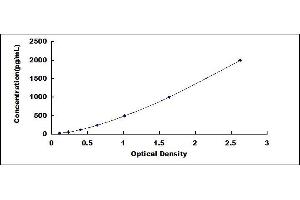 Typical standard curve (Anti-Chloride Intracellular Channel Protein 1 Antibody (Anti-CLIC1) ELISA Kit)