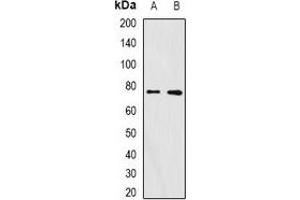 Western blot analysis of FURIN expression in A375 (A), mouse ovary (B) whole cell lysates. (FURIN Antikörper)