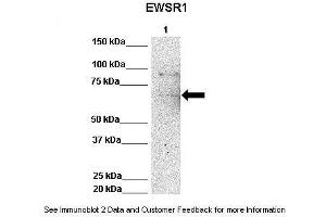Lanes:   Lane 1: 50ug Hela Lysate  Primary Antibody Dilution:   1:1000  Secondary Antibody:   Anti-rabbit-HRP  Secondary Antibody Dilution:   1:10,000  Gene Name:   EWSR1  Submitted by:   Archa Fox, University of Western Australia  EWSR1 is strongly supported by BioGPS gene expression data to be expressed in Human HeLa cells (EWSR1 Antikörper  (Middle Region))