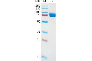Human IL1RA Protein, hFc Tag on SDS-PAGE under reducing condition. (IL1RN Protein (AA 18-332) (Fc Tag))