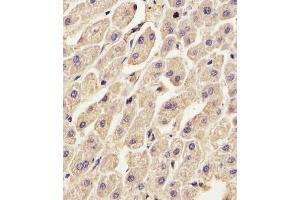 (ABIN391619 and ABIN2841538) staining ANXA2 in Human liver tissue sections by Immunohistochemistry (IHC-P - paraformaldehyde-fixed, paraffin-embedded sections). (Annexin A2 Antikörper  (N-Term))