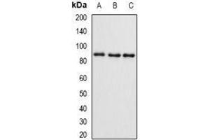 Western Blotting (WB) image for anti-SET and MYND Domain Containing 4 (SMYD4) (AA 1-260) antibody (ABIN5936313) (SMYD4 Antikörper  (AA 1-260))