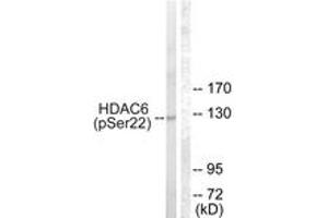 Western blot analysis of extracts from NIH-3T3 cells treated with Anisomycin 25ug/ml 30', using HDAC6 (Phospho-Ser22) Antibody. (HDAC6 Antikörper  (pSer22))