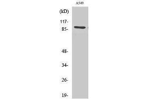 Western Blotting (WB) image for anti-Suppression of Tumorigenicity 14 (Colon Carcinoma) (ST14) (N-Term) antibody (ABIN3185477) (ST14 Antikörper  (N-Term))