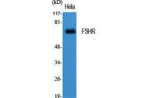 Western Blot (WB) analysis of specific cells using FSHR Polyclonal Antibody. (FSHR Antikörper  (Internal Region))