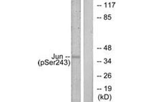 Western Blotting (WB) image for anti-Jun Proto-Oncogene (JUN) (pSer243) antibody (ABIN2888453) (C-JUN Antikörper  (pSer243))
