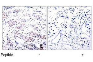 Image no. 1 for anti-ELK1, Member of ETS Oncogene Family (ELK1) (Ser383) antibody (ABIN197098) (ELK1 Antikörper  (Ser383))