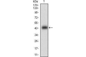 Western blot analysis using CNN1 mAb against human CNN1 (AA: 16-165) recombinant protein. (CNN1 Antikörper  (AA 16-165))