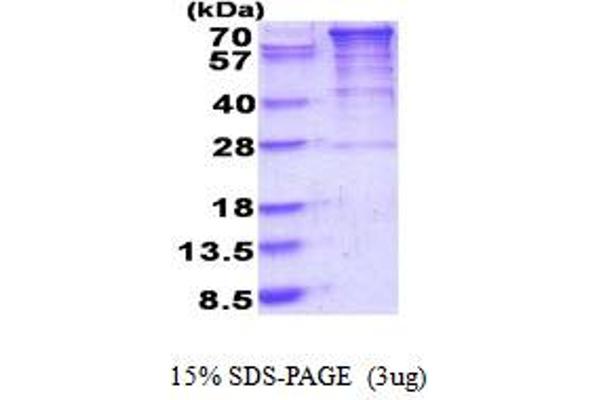 EEF2K Protein (AA 1-725) (His tag)