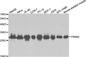 Western blot analysis of extracts of various cell lines, using PSMA6 antibody (ABIN5971214) at 1/1000 dilution. (PSMA6 Antikörper)