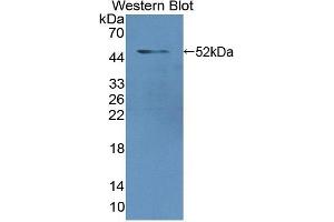 Detection of Recombinant LMNA, Human using Polyclonal Antibody to Lamin A/C (LMNA) (Lamin A/C Antikörper  (AA 1-422))