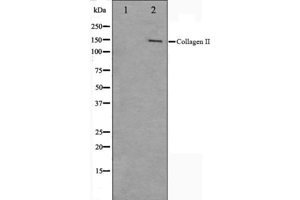 COL2A1 Antikörper  (N-Term)