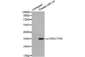 Western blot analysis of extracts from HeLa cells using Phospho-CDK2-T160 antibody (ABIN2987938). (CDK2 Antikörper  (pThr160))