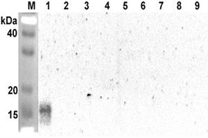 ANGPTL5 Antikörper  (Coiled coil domain)