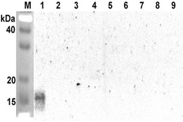 ANGPTL5 Antikörper  (Coiled coil domain)