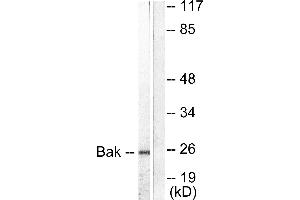 Western blot analysis of extracts from 293 cells, using Bak antibody (#C0131). (BAK1 Antikörper)