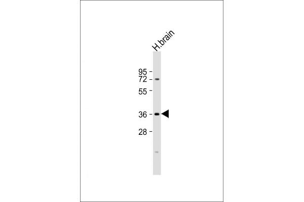 NMNAT1 Antikörper  (AA 171-201)