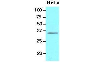 Cell lysates of HeLa(20 ug) were resolved by SDS-PAGE, transferred to nitrocellulose membrane and probed with anti-human BRCC36 (1:1000). (BRCC3 Antikörper  (AA 1-316))