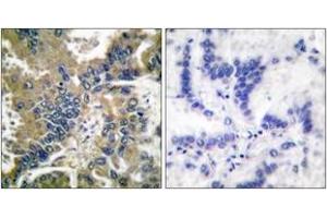 Immunohistochemistry (IHC) image for anti-Caspase 1 (CASP1) (AA 161-210), (Cleaved-Asp210) antibody (ABIN2891162) (Caspase 1 Antikörper  (Cleaved-Asp210))