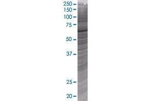 Western Blotting (WB) image for STXBP1 293T Cell Transient Overexpression Lysate(Denatured) (ABIN1333617)