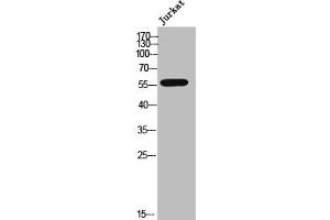 Western Blot analysis of Jurkat cells using CYP3A4/5 Polyclonal Antibody (CYP3A4 Antikörper  (Internal Region))