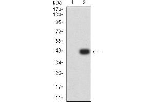 Western blot analysis using RIPK4 mAb against HEK293 (1) and RIPK4 (AA: 675-784)-hIgGFc transfected HEK293 (2) cell lysate. (RIPK4 Antikörper  (AA 675-784))