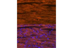 Immunofluorescence analysis of rat heart using Myosin heavy chain Rabbit mAb (ABIN7268750) at dilution of 1:100 (40x lens). (MYH7 Antikörper)
