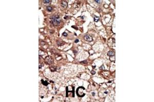 Immunohistochemistry (Paraffin-embedded Sections) (IHC (p)) image for anti-Epidermal Growth Factor Receptor Pathway Substrate 8 (EPS8) (AA 9-39), (N-Term) antibody (ABIN392773)