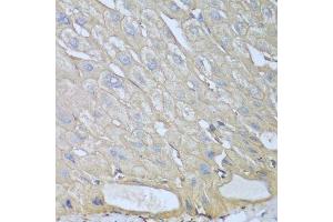 Immunohistochemistry of paraffin-embedded human liver using RPH3AL antibody. (RPH3AL Antikörper  (AA 161-315))