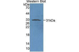 Western blot analysis of recombinant Rat NCR1. (NCR1 Antikörper  (AA 17-258))