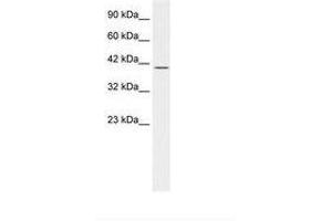 Image no. 1 for anti-POU domain, class 2, transcription factor 2 (POU2F2) (AA 26-75) antibody (ABIN202584) (Oct-2 Antikörper  (AA 26-75))