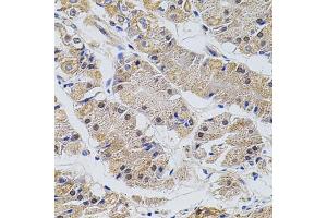 Immunohistochemistry of paraffin-embedded human stomach using TRMT2A antibody (ABIN5973559) at dilution of 1/100 (40x lens). (TRMT2A Antikörper)