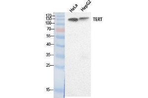 Western Blotting (WB) image for anti-Telomerase Reverse Transcriptase (TERT) (Internal Region) antibody (ABIN3178530) (TERT Antikörper  (Internal Region))