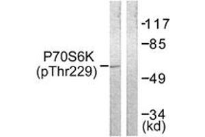 Western blot analysis of extracts from Jurkat cells, using p70 S6 Kinase (Phospho-Thr229) Antibody. (RPS6KB1 Antikörper  (pThr229))