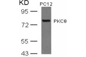 Image no. 3 for anti-Protein Kinase C, theta (PRKCQ) (AA 674-678) antibody (ABIN197567) (PKC theta Antikörper  (AA 674-678))