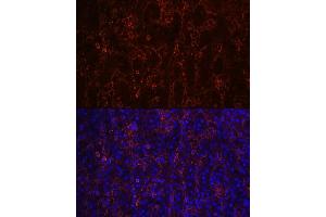 Immunofluorescence analysis of human spleen using CD23 Rabbit mAb (ABIN7267160) at dilution of 1:100 (40x lens). (FCER2 Antikörper)
