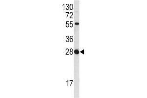 Western Blotting (WB) image for anti-Fibroblast Growth Factor 18 (FGF18) antibody (ABIN3002728) (FGF18 Antikörper)