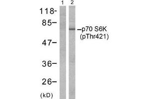 Western blot analysis of extracts from Jurkat cells, untreated or treated with GM-CSF (25ng/ml 30min) using p70 S6 Kinase (phospho-Thr421) antibody (E011254, Line 1 and 2). (RPS6KB1 Antikörper  (pThr421))