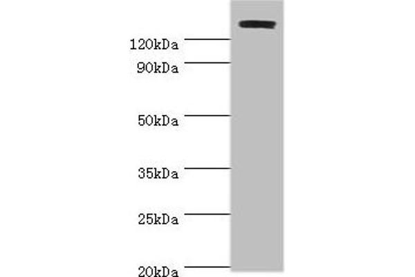 TP53BP2 Antikörper  (AA 360-600)