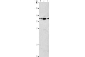 Western Blotting (WB) image for anti-rho Guanine Nucleotide Exchange Factor (GEF) 7 (ARHGEF7) antibody (ABIN2429254) (ARHGEF7 Antikörper)