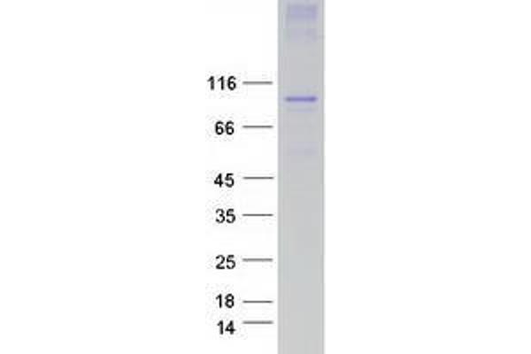 TRPC3 Protein (Transcript Variant 2, Trp3) (Myc-DYKDDDDK Tag)