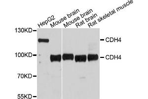Western blot analysis of extracts of various cell lines, using CDH4 antibody (ABIN5997416) at 1/1000 dilution. (Cadherin 4 Antikörper)