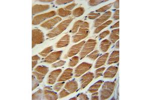 Immunohistochemistry (IHC) image for anti-Acyl-CoA Dehydrogenase, Long Chain (ACADL) antibody (ABIN3003793) (ACADL Antikörper)