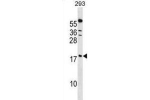 Western Blotting (WB) image for anti-Peptidylprolyl Isomerase (Cyclophilin)-Like 1 (PPIL1) antibody (ABIN2998971) (PPIL1 Antikörper)