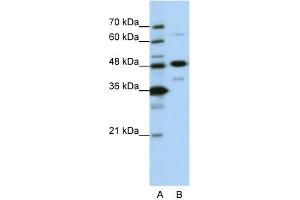 WB Suggested Anti-NOL4 Antibody Titration:  0. (NOL4 Antikörper  (N-Term))