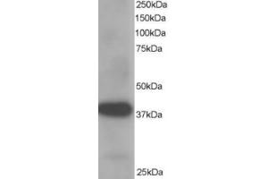 Western Blotting (WB) image for anti-Aldo-Keto Reductase Family 1, Member B1 (Aldose Reductase) (AKR1B1) (C-Term) antibody (ABIN2465387) (AKR1B1 Antikörper  (C-Term))
